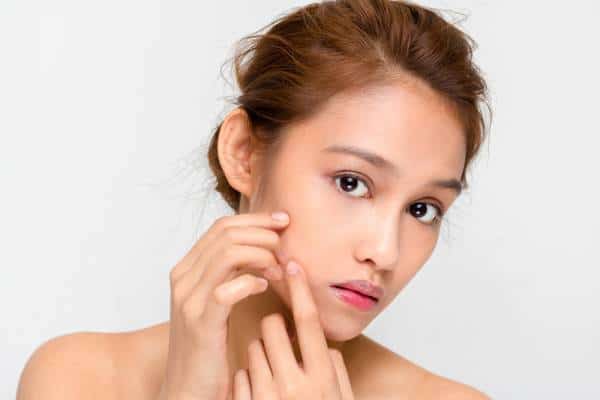 זה ב-DNA שלנו: יתכן ובקרוב נזכה לטיפול טוב יותר באקנה הודות למחקר חדש