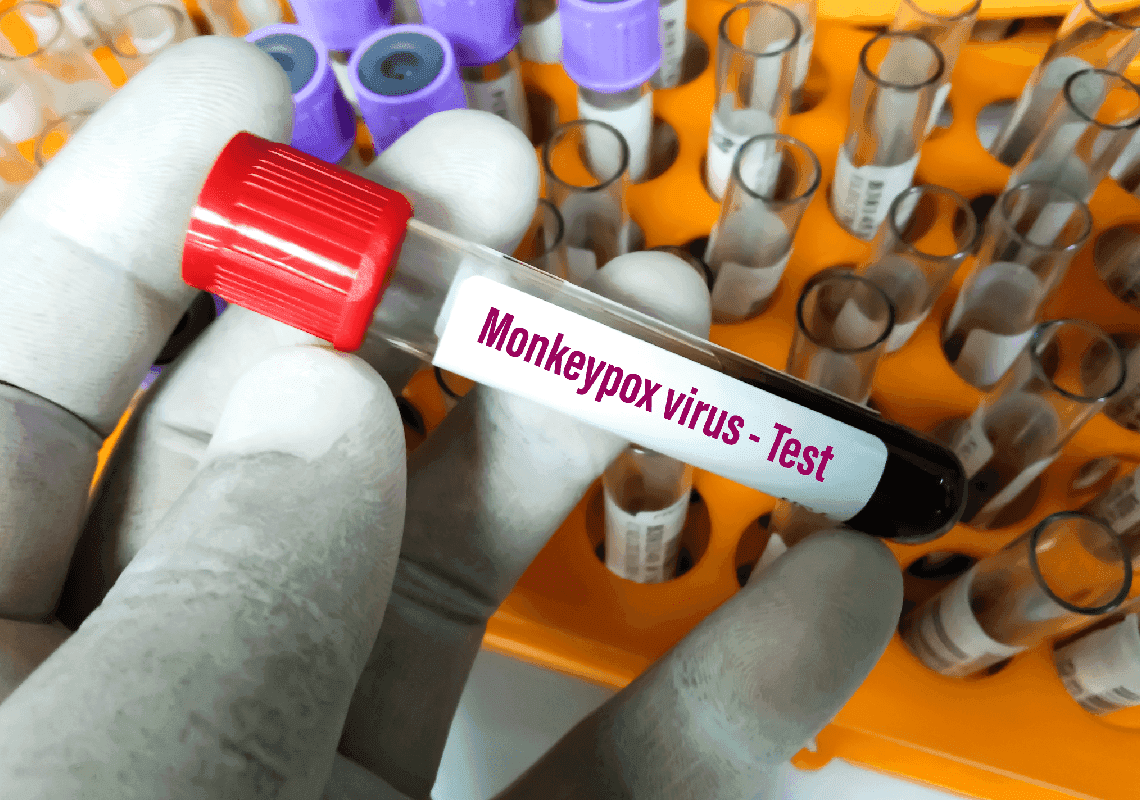 לוס אנג'לס: נקבע מותו של אדם שאובחן עם אבעבועות הקופים 