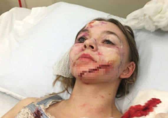 הגרסה של טיילור היקסון ל'פני הצלקת'