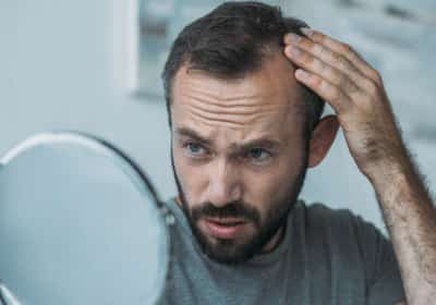 תרופה פופולרית להתקרחות עלולה לגרום למחשבות אובדניות: ממצאים מדאיגים ממחקר ישראלי