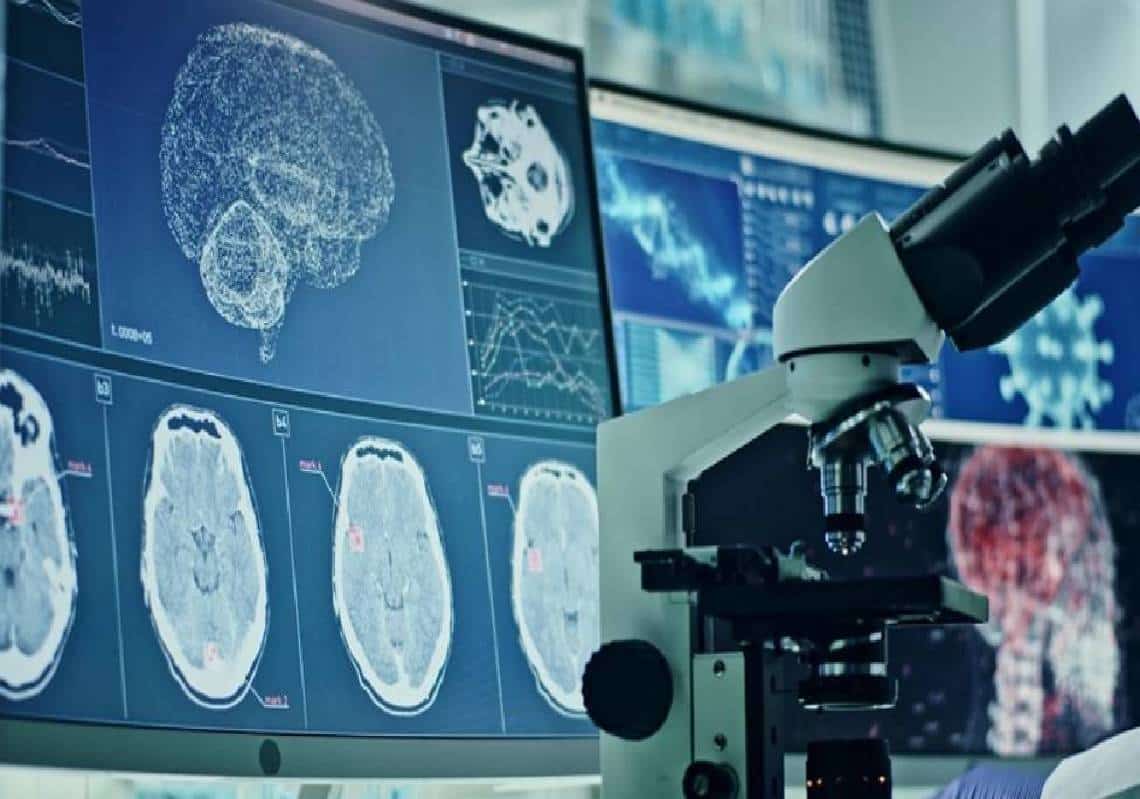 "קורונה מובילה לשינוי מוחי ולתסמינים דמויי-אלצהיימר": כך התגלה במחקר חדש המבוסס על טכנולוגיית בינה מלאכותית