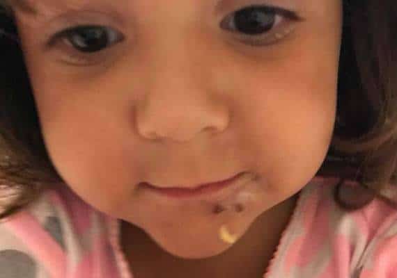 פלורידה: בת 3 פונתה לבית חולים בעקבות זיהום בחוף הים