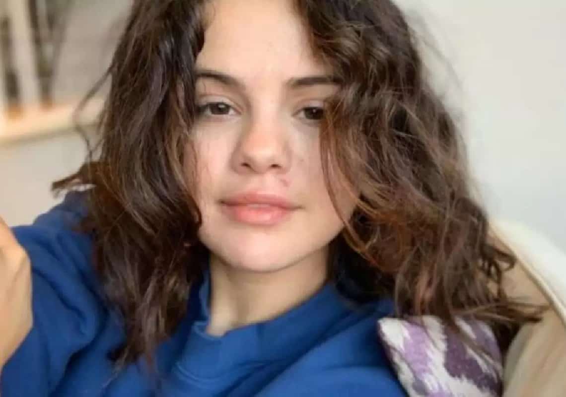 מול מיליוני עוקבים: סלינה גומז משתפת סלפי אמיץ במיוחד