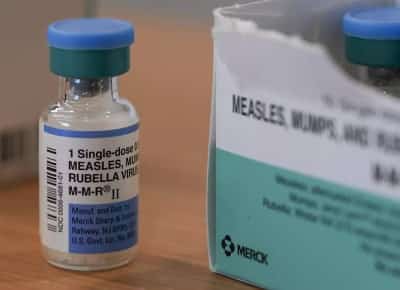 החצבת חוזרת : מעל אלף מקרים השנה - המספר הגבוה ביותר מזה עשורים