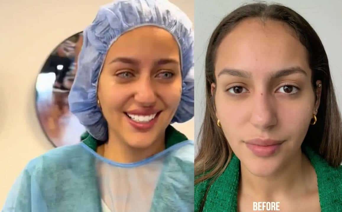 ‏הליך קוסמטי לשינוי צבע העיניים הופך לוויראלי - אבל כך גם סיפורי הזוועה‏