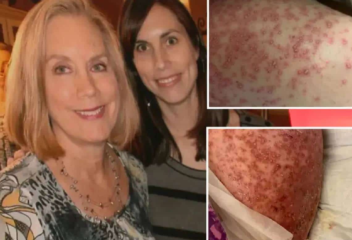 סרט אימה שהתגשם: "נמלים טורפות-בשר אכלו את אמא שלנו ובית האבות התעלם"