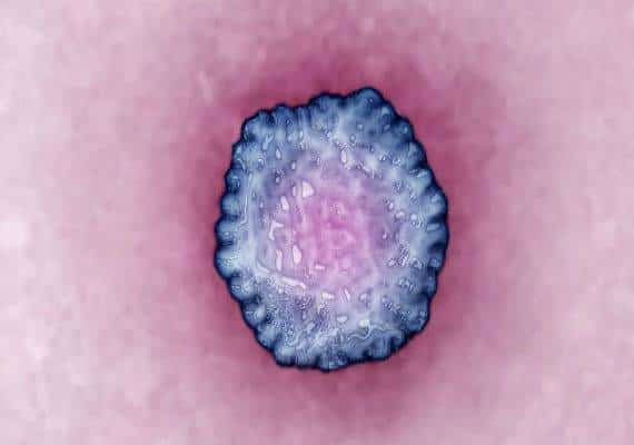 קנטקי ואינדיאנה: 3 אנשים מתו לאחר שנדבקו בנגיף הפטיטיס A ומגמת העליה במספר מקרי ההידבקות נמשכת