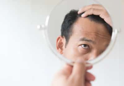 פריצת דרך בספרד: טיפול נגד התקרחות רשם מאה אחוזי הצלחה