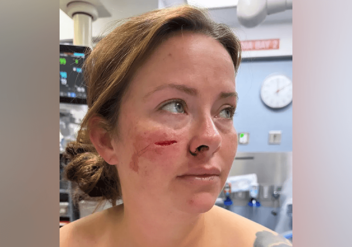 שדה"ת ניוארק: עבריין מורשע שהשתחרר מהכלא – דקר אישה זרה בפנים