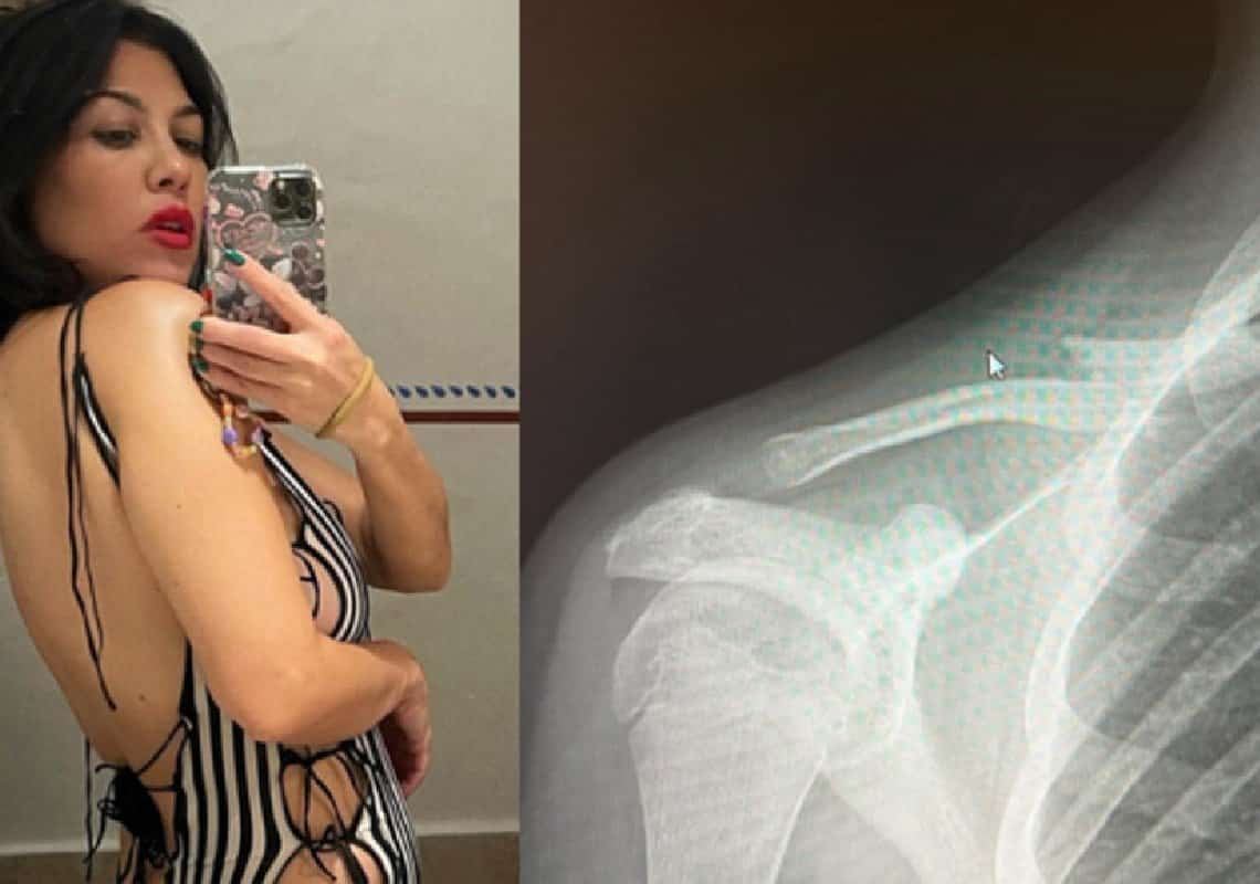 מעוררת דאגה: צילום הרנטגן של קורטני קרדשיאן