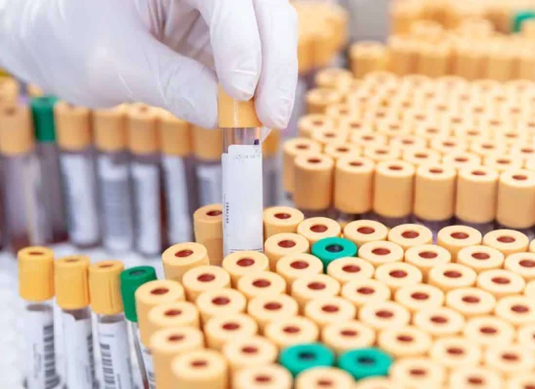 חרדה באוסטרליה: מאות דגימות של וירוסים קטלניים נעלמו ממעבדה ממשלתית