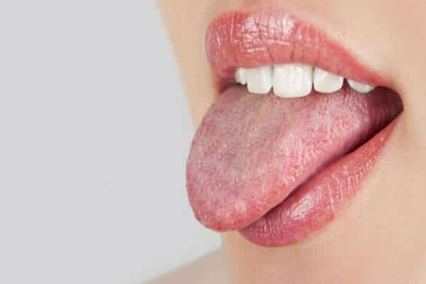 שערות על הלשון זו לא קללה מהאגדות: מסתבר שזה יכול לקרות לאחר טיפול אנטיביוטי