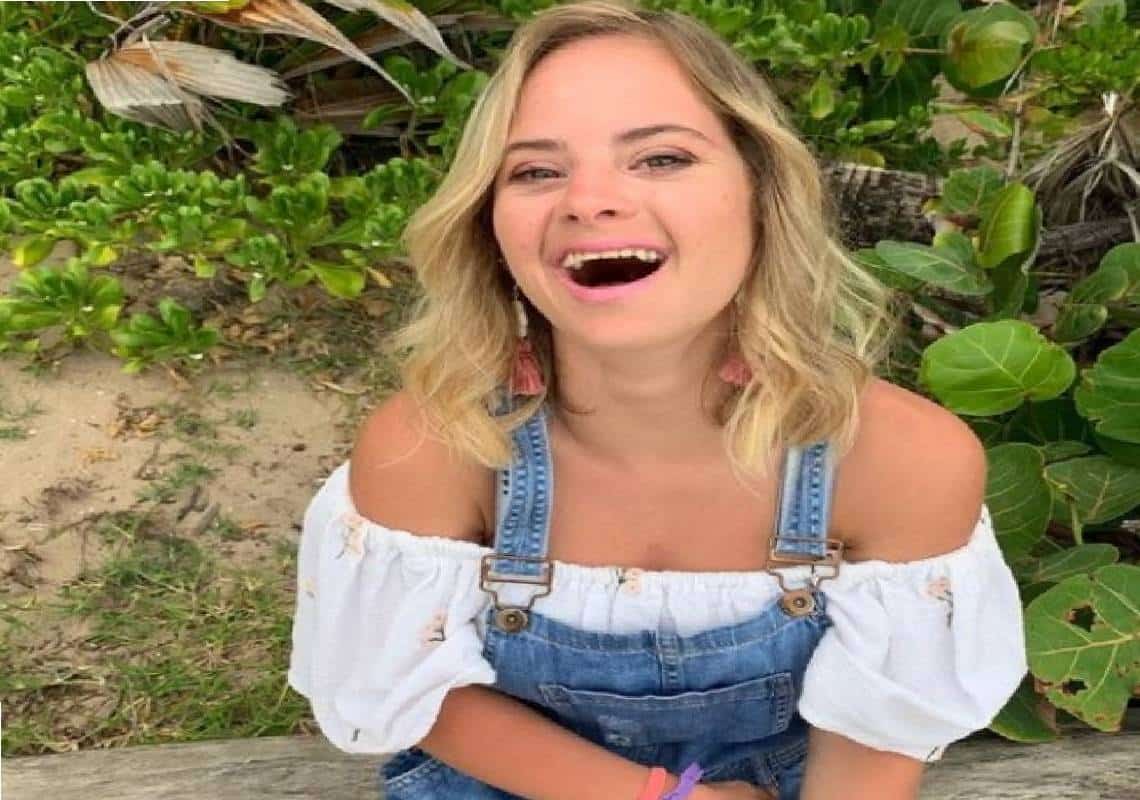 לראשונה ב״ויקטוריה סיקרט״: דוגמנית עם תסמונת דאון