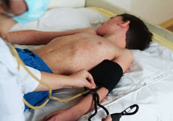 התפרצות מגיפת החצבת: שני בתי ספר יהודיים נסגרו בהוראת גורמי בריאות